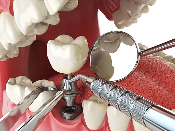 Best Emergency Treatment for Jaw Pain or Injury in Coram, NY