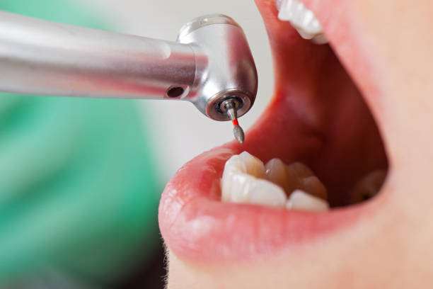 Best Emergency Treatment for Oral Infections in Coram, NY